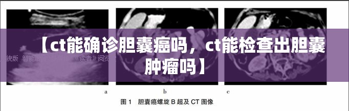 【ct能确诊胆囊癌吗，ct能检查出胆囊肿瘤吗】