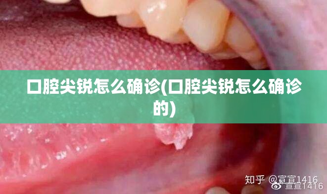 口腔尖锐怎么确诊(口腔尖锐怎么确诊的)
