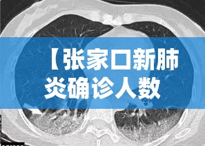 【张家口新肺炎确诊人数，张家口市确诊新型冠状病毒】
