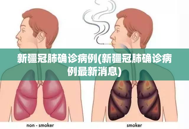 新疆冠肺确诊病例(新疆冠肺确诊病例最新消息)
