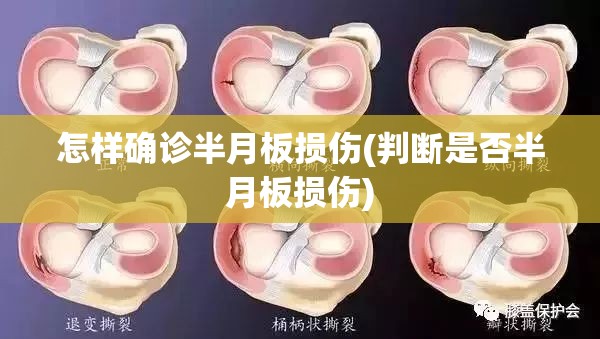 怎样确诊半月板损伤(判断是否半月板损伤)