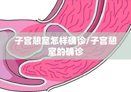 子宫憩室怎样确诊/子宫憩室的确诊