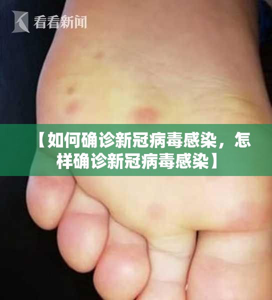 【如何确诊新冠病毒感染，怎样确诊新冠病毒感染】
