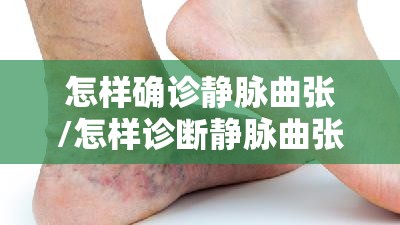 怎样确诊静脉曲张/怎样诊断静脉曲张